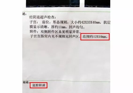 这几种妇科病其实根本不用治,妇科病怎样才可以完全治愈