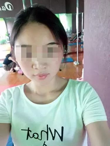 女子花3万整容后续,女子花1600万整容失败后续