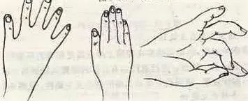 脑梗死康复全过程,脑梗死的康复手法视频