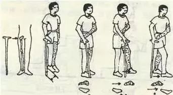 脑梗死康复全过程,脑梗死的康复手法视频