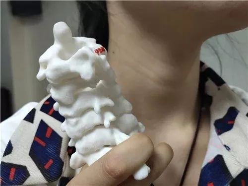 全球首例3d打印人工椎间盘置换术,世界首例3d打印距骨移植手术