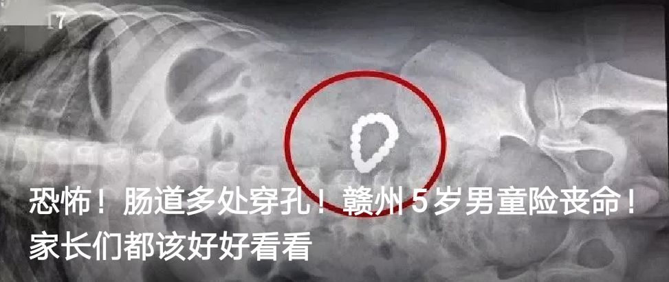 江西赣州三支一扶的报考条件,三支一扶报考条件和要求江西赣州