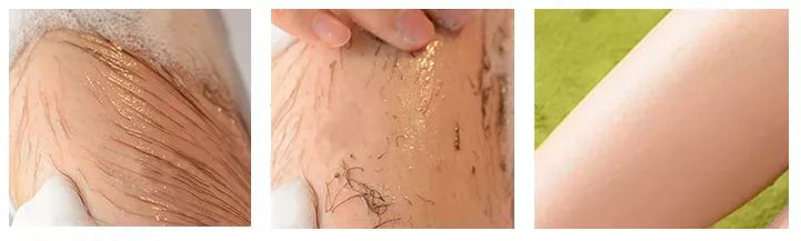 脱毛没那么复杂来这里三步搞定,这才是夏天脱毛的正确打开方式