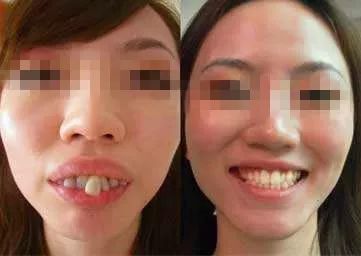 26岁女孩相亲6次没成功,90后女子5次相亲都被拒