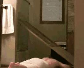 面部皮瓣美容缝合,面部美容线缝合恢复效果图