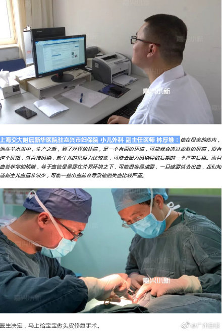 婴儿头上少一块皮肤,婴儿头上少块皮肤