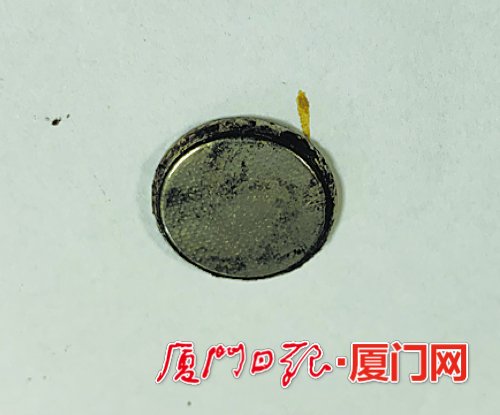 小孩误吞纽扣电池卡在食道口,误吞纽扣电池两幼童食道被腐蚀