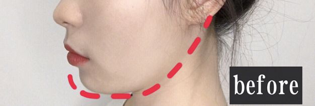 燃脂瘦身的最有效产品,燃脂神器视频大全