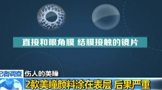 正在被美瞳毁掉的女孩,正在被美瞳毁掉的女人们