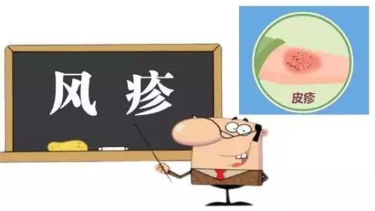 风疹为啥不让见风,风疹不治自愈吗