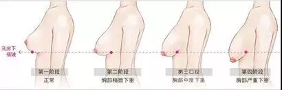 小红书同款爆款内衣聚拢女防下垂,小红书同款爆款夏季内衣女无钢圈