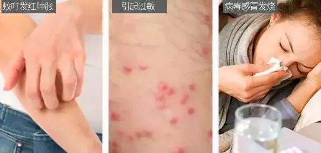 驱蚊神器灭蚊灯静音无辐射,灭蚊灯是根据什么原理灭蚊的