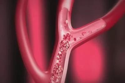 杨柳絮有什么副作用,杨柳絮的副作用和危害