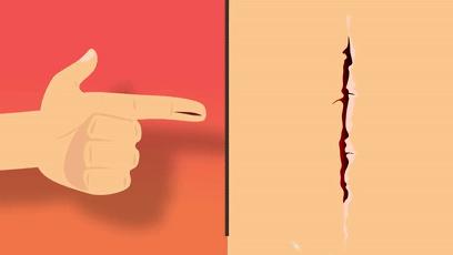 为什么被纸割到很疼,手指被纸割破