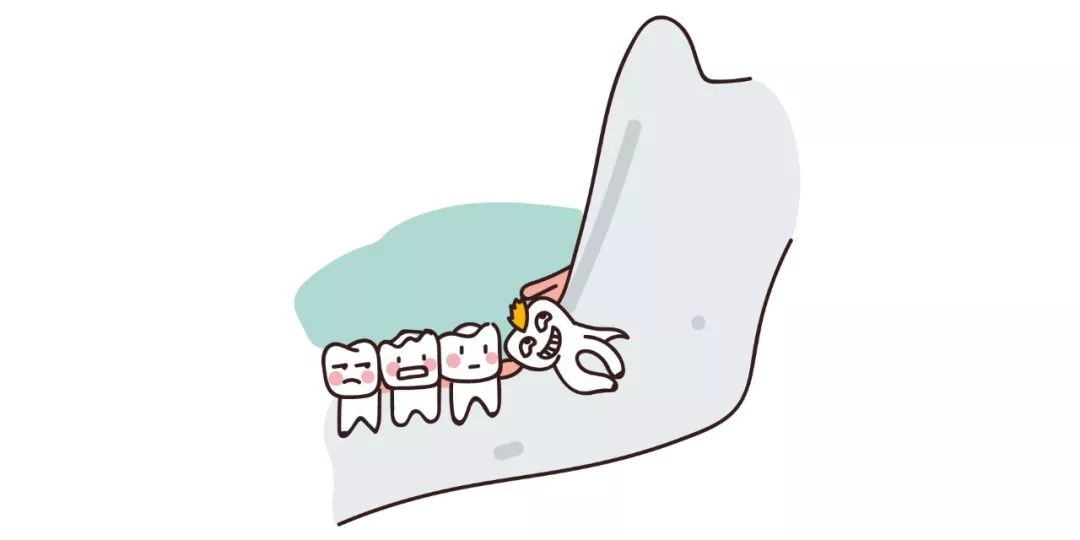拔智齿注意事项漫画,漫画科普牙科