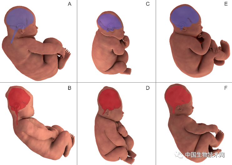 胎儿3d表面成像,3d影像婴儿诞生全过程