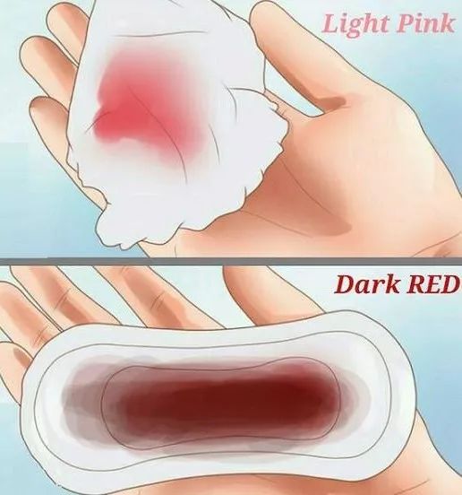 医生:警惕月经异常隐藏疾病信号,月经小常识医学科普