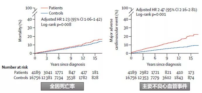 甲亢治疗是药物好还是碘131好,甲亢治疗中药还是西药