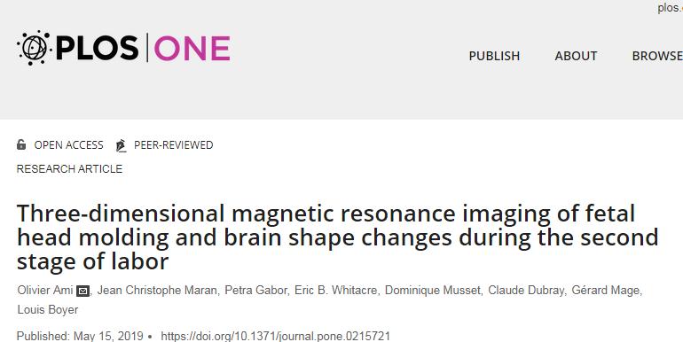 PLOSOne:为什么婴儿刚生下来头容易变形?科学家3D图像揭秘其中“奥妙”