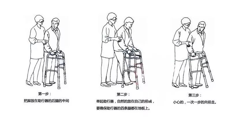 老年人股骨颈骨折康复教程,70岁股骨颈骨折保守治疗成功案例