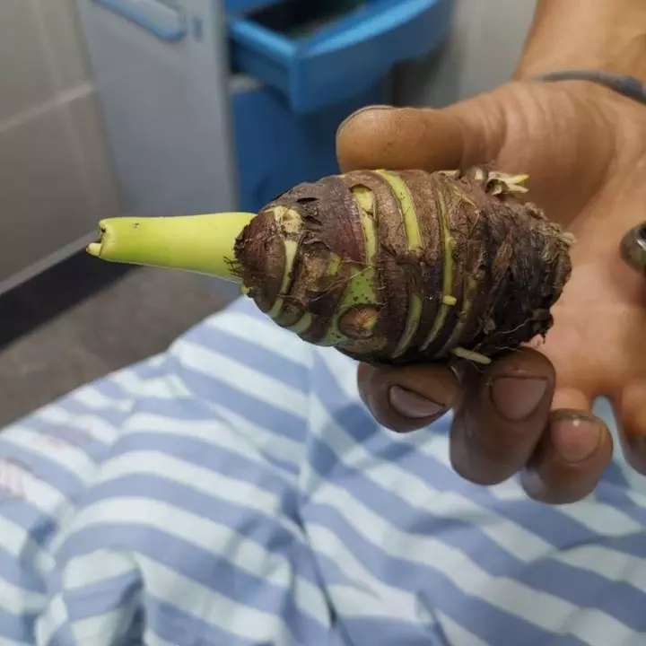 没煮熟的芋头吃了会不会中毒,芋头不成熟吃了会中毒吗