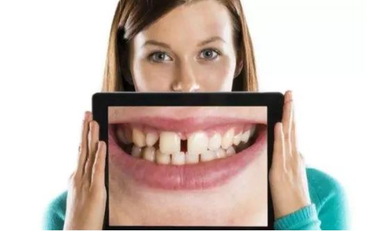 注意口腔问题,当心牙缝