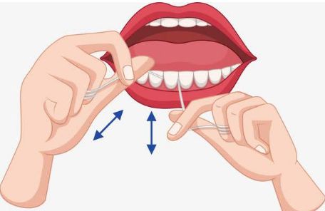 注意口腔问题,当心牙缝