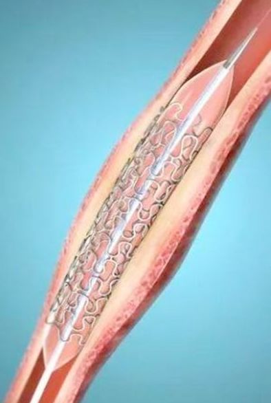 王清任的36个方剂分别治疗什么病,王清海中医治疗扩心病