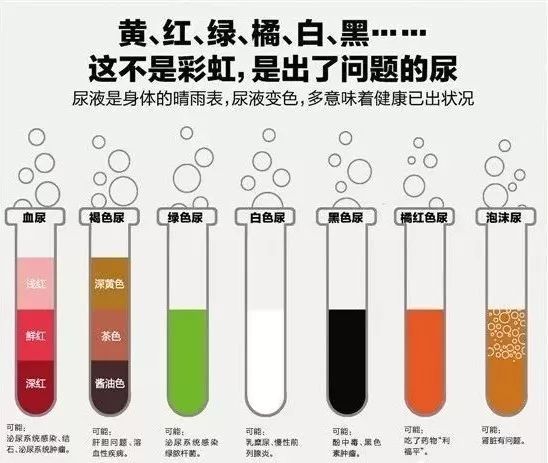 尿里有细菌但是没有白细胞,尿里有细菌但是尿培养没事