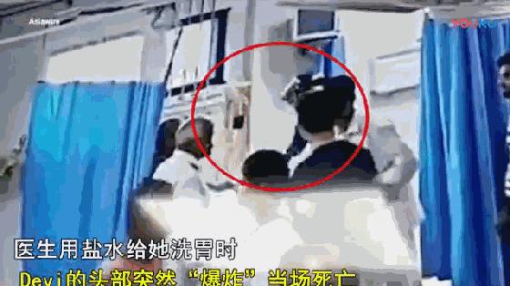 器官爆炸的威力有多大,能量外科是做什么的