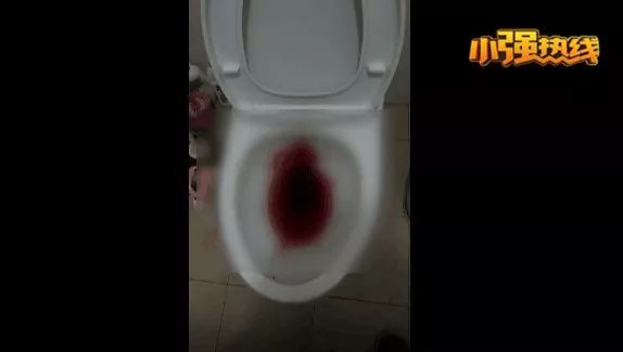 男子性功能障碍，40岁未婚，治疗后大出血