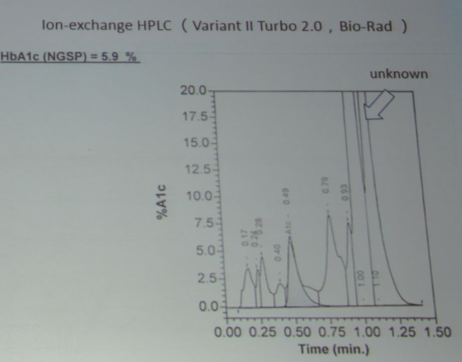 周翔海教授：糖化血红蛋白测量值不准确可能与这些因素有关|PUDF2019