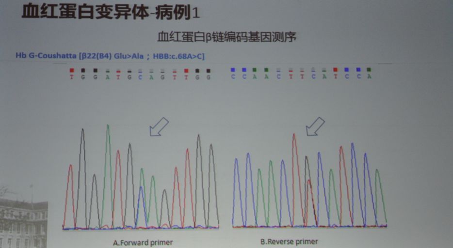 周翔海教授：糖化血红蛋白测量值不准确可能与这些因素有关|PUDF2019