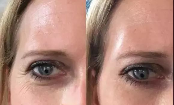 熬夜急救大牌面霜,熬夜急救涂抹大牌面膜