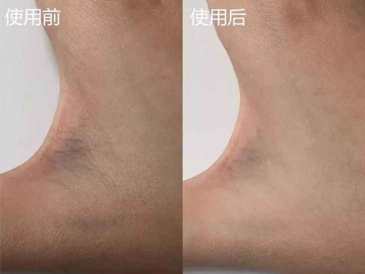 熬夜急救大牌面霜,熬夜急救涂抹大牌面膜