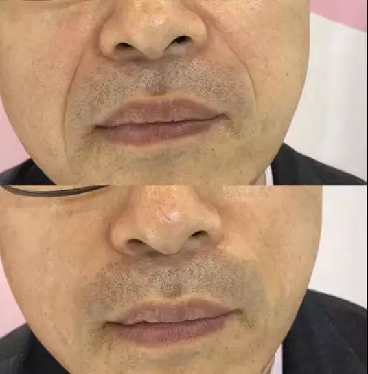 熬夜急救大牌面霜,熬夜急救涂抹大牌面膜