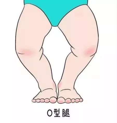 图解鞋底磨损4大类型,一个月鞋底就磨损是不是质量问题