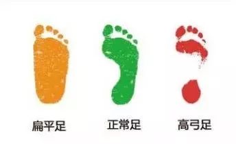 图解鞋底磨损4大类型,一个月鞋底就磨损是不是质量问题