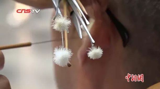 采耳最好的技术,关于友谊的科普知识