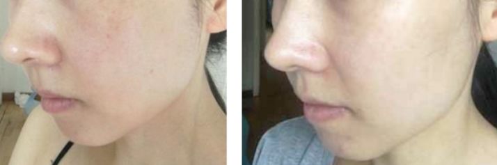 泰国VC保湿爽肤水,泰国vc美白保湿淡斑爽肤水500m