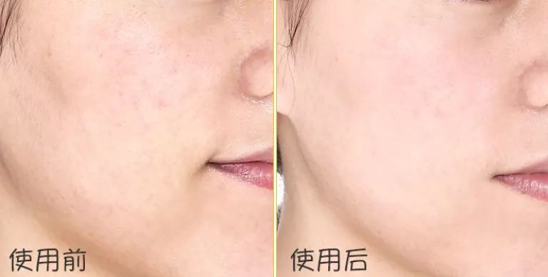 泰国VC保湿爽肤水,泰国vc美白保湿淡斑爽肤水500m