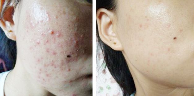 泰国VC保湿爽肤水,泰国vc美白保湿淡斑爽肤水500m