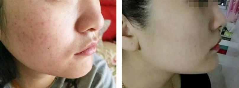 泰国VC保湿爽肤水,泰国vc美白保湿淡斑爽肤水500m