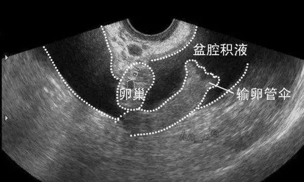 女生必知的10条妇科常识，最后一条特别重要！