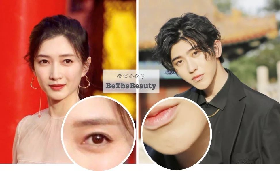 重要场合灰头土脸?16条急救措施帮你焕然一新!