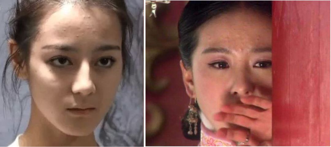 重要场合灰头土脸?16条急救措施帮你焕然一新!