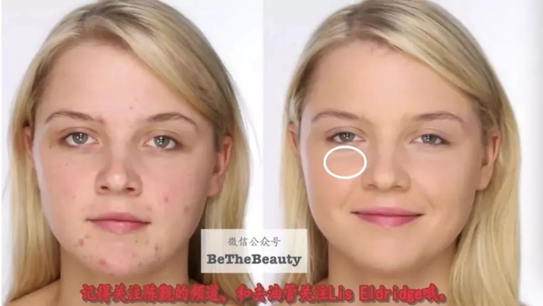 重要场合灰头土脸?16条急救措施帮你焕然一新!