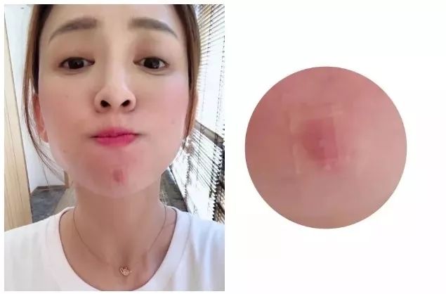 重要场合灰头土脸?16条急救措施帮你焕然一新!