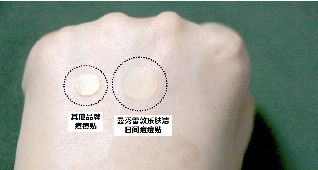 重要场合灰头土脸?16条急救措施帮你焕然一新!