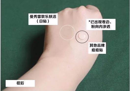 重要场合灰头土脸?16条急救措施帮你焕然一新!